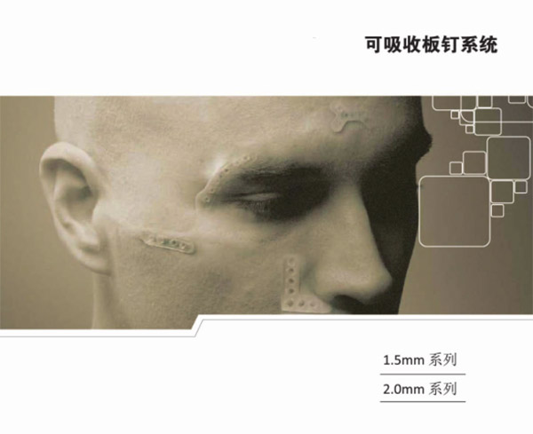 可吸收板钉系统